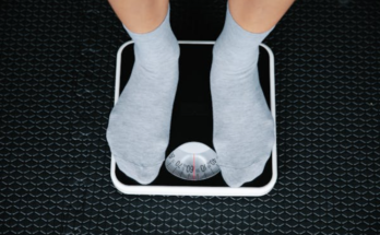 How to Avoid Loose Skin After Weight Loss: Complete Guide