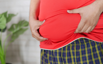 Hormonal Belly Fat: What It Is and How to Get Rid of It Naturally”